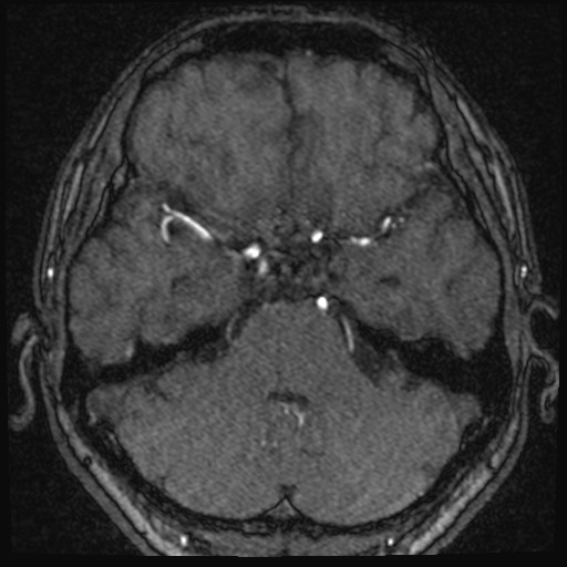 Click on the Serie image to view the images of VILLANUEVA, WILLIAM A.